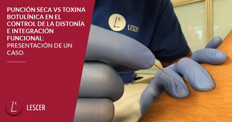 Rehabilitación neurológica, neurorrehabilitación, tratamiento daño cerebral adquirido, rehabilitación ictus, Centro Lescer Madrid Fundación Lescer