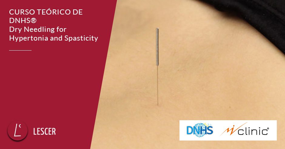 La técnica DNHS® de punción seca utilizada para disminuir la hipertonía, la espasticidad y mejorar la funcionalidad de personas con lesión del sistema nervioso central.