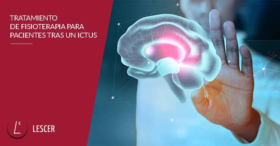 Tratamiento de fisioterapia para pacientes tras un ictus