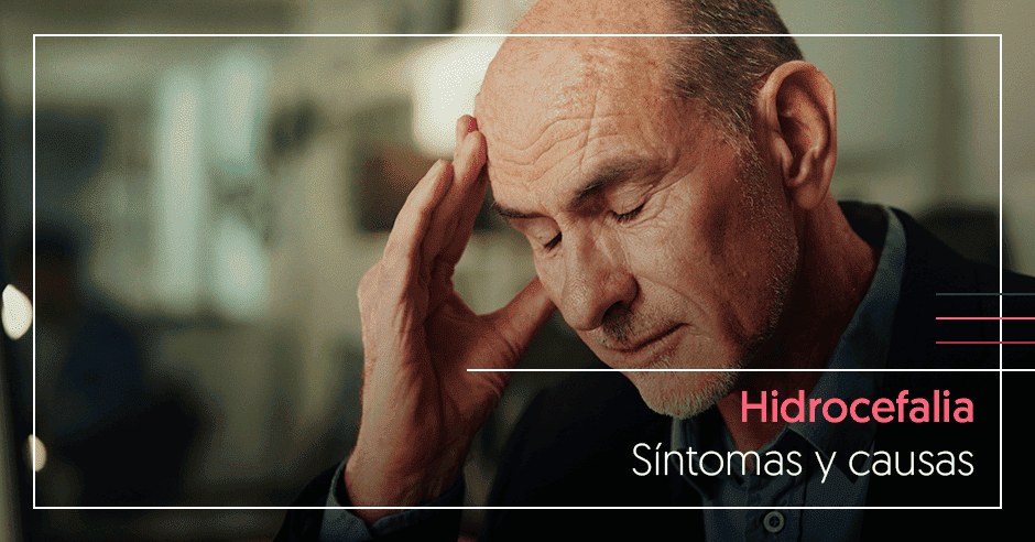 Hidrocefalia - sintomas y causas
